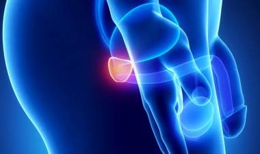 Salud brindó recomendaciones por el día del cáncer de próstata