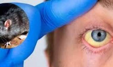 Leptospirosis: Provincia recuerda las medidas de prevención